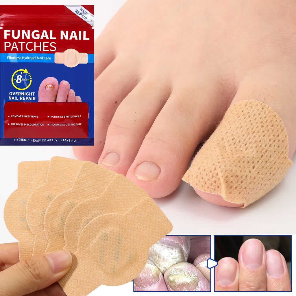 Waterproof Nail Surface Patch Toe Adjust Stickers Damaged Daily Foot Qme