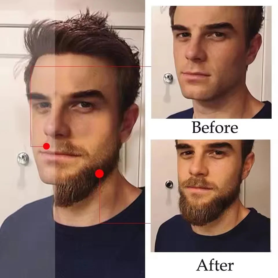 High Quality Fast Beard Growth Serum For Men Promote Beard Regrowth Thicker Longer Fuller Anti Hair Loss Essential Oil Hair Care Qme