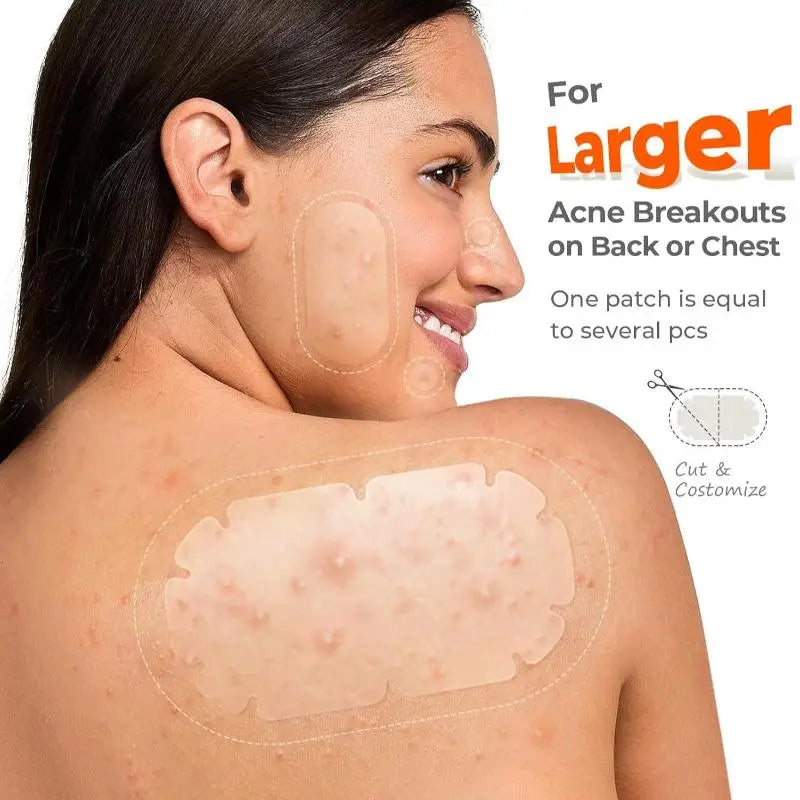Hydrocolloid Acne Patches Multi-shape Invisible Bulk-pack Facial Body Qme