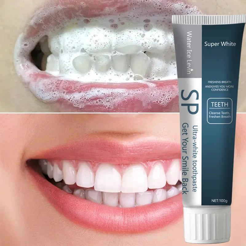SP Probiotic Toothpaste Whiten Toothpaste Clean Mouth Stain Remove Fresh Breath Soft Foam Protect Gum Whiten Teeth Oral Care Qme