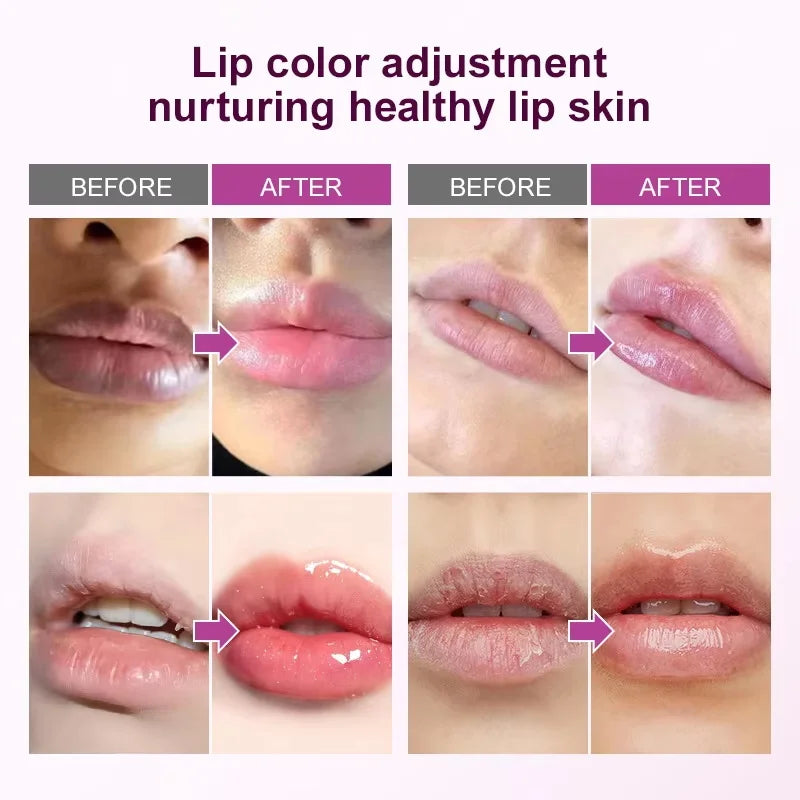Remove Dark Lip Balm Fast Lightening Pink Lip Exfoliating Fade Lip Line Dead Skin Moisturizer Korean Care Products Beauty Health Qme