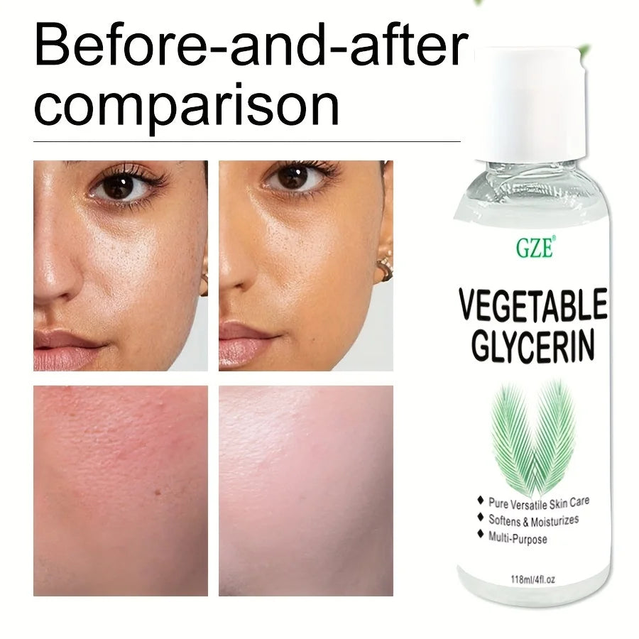 GZE Vegetable Glycerin, 100% Pure, Versatile Skin Care, Softening and Moisturizing, Multi-PURPOSE AND VERSATILE SKIN CARE Qme
