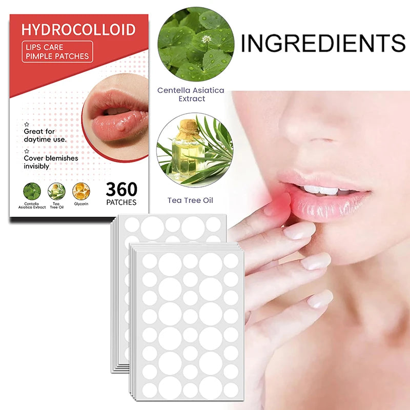 Mouth Blister Patch Cold Sore Lip Healing Hydrocolloid Care Stickers Qme