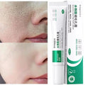 Salicylic Acid Pore Clearing Cream Shrink Pores Remove Blackheads Acne Brighten Moisturizing Smooth Skin Care Korean Products Qme 1pc