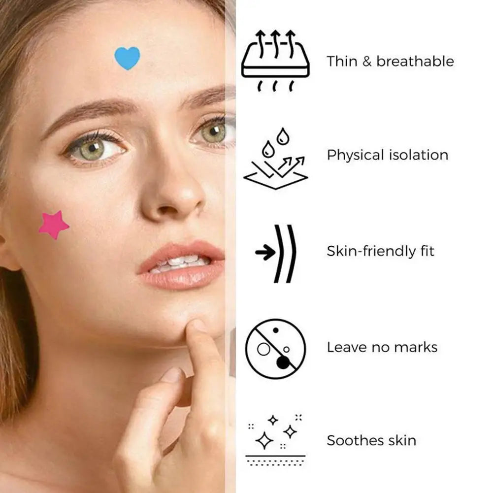 Xingxing Love Mixed 240/360/540 Patches Acne Patch Dispel Acne Patch Acne Clear Acne Patch Invisible Acne Printing Patch Qme