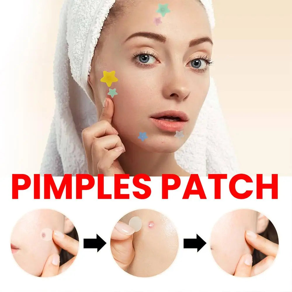 200 Counts Colorful Hydrocolloid Cute Star Shaped Acne Pimple Patch For Face Invisible Zit Cover Stickers Skin Care Qme