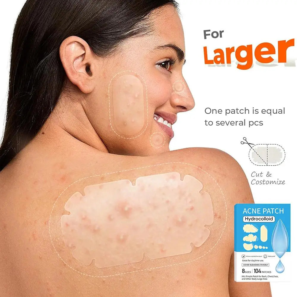 Large Pimple Patches Bulk Face 5 Sizes Hydrocolloid Acne Covering Qme