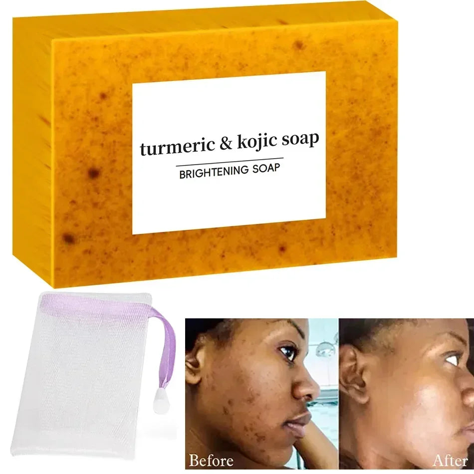Turmeric Kojic Acid Glow Soap Dark Spot Acne Removal Even Skin Tone Mositen Smooth Skin Deep Cleansing Handmade Soap Qme
