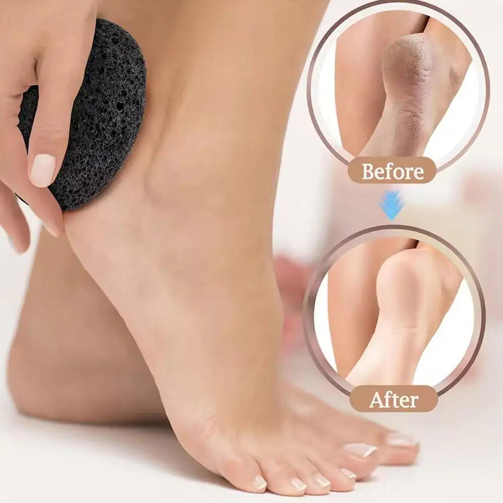 Natural Pumice Stone For Exfoliation - Unscented,Foot & Hand Foot File, Remover For Smooth Feet And Hands, Ideal For Home Use Qme