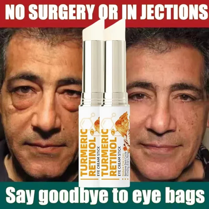 Instant Eye Bag Remove Eye Cream Anti Fat Particles Dark Circles Puffiness Fade Fine Lines Lift Brighten Korean Beauty Eye Care Qme