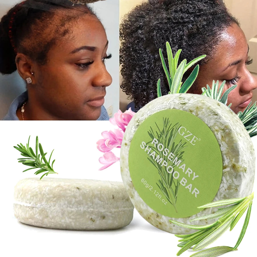 GZE Rosemary Hair Strengthens Shampoo Bar: Cleanses and Helps Strengthen Weak and Brittle Hair Qme