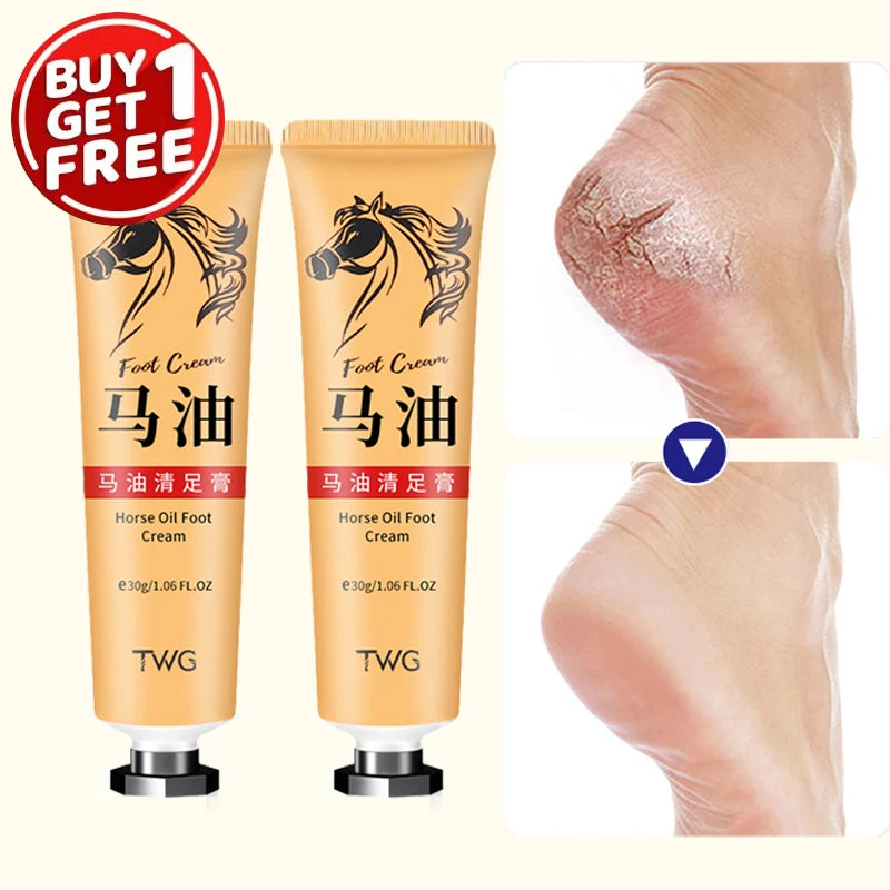 Ma You Qing Foot Cream Moisturizing Suitable Dry Skin Hand Care Hands Qme 2pcs