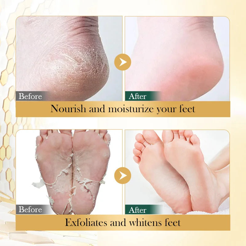 Vitamin E Foot Mask Manuka Honey Nourishing Long-lasting Moisturizing Hydrating Exfoliating Remove Dead Skin Foot Skin Care Qme