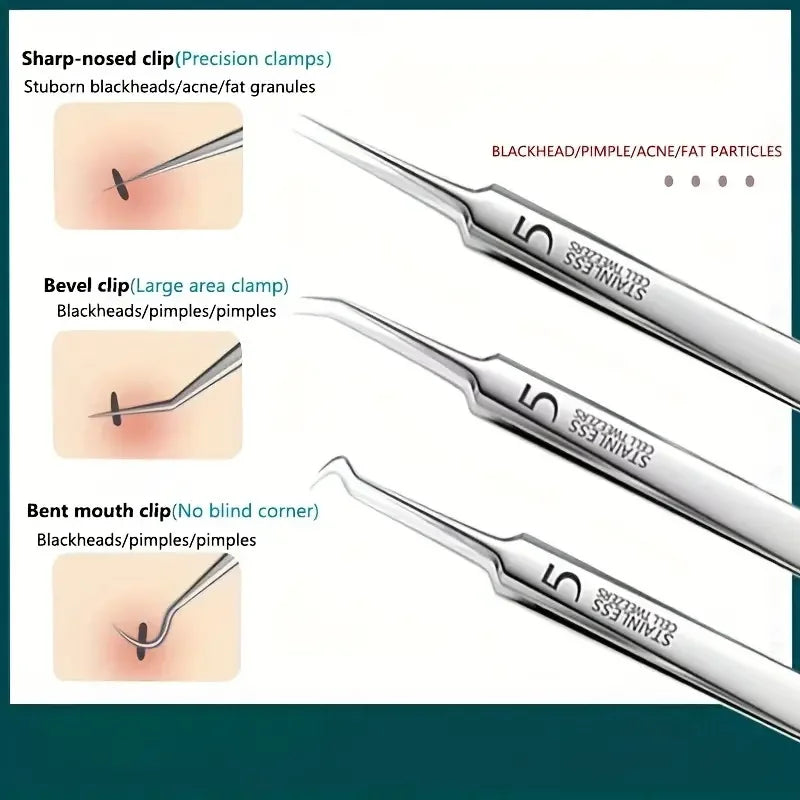 Stainless Steel Acne Clip Cell Blackhead Needle Beauty Salon Tool Qme