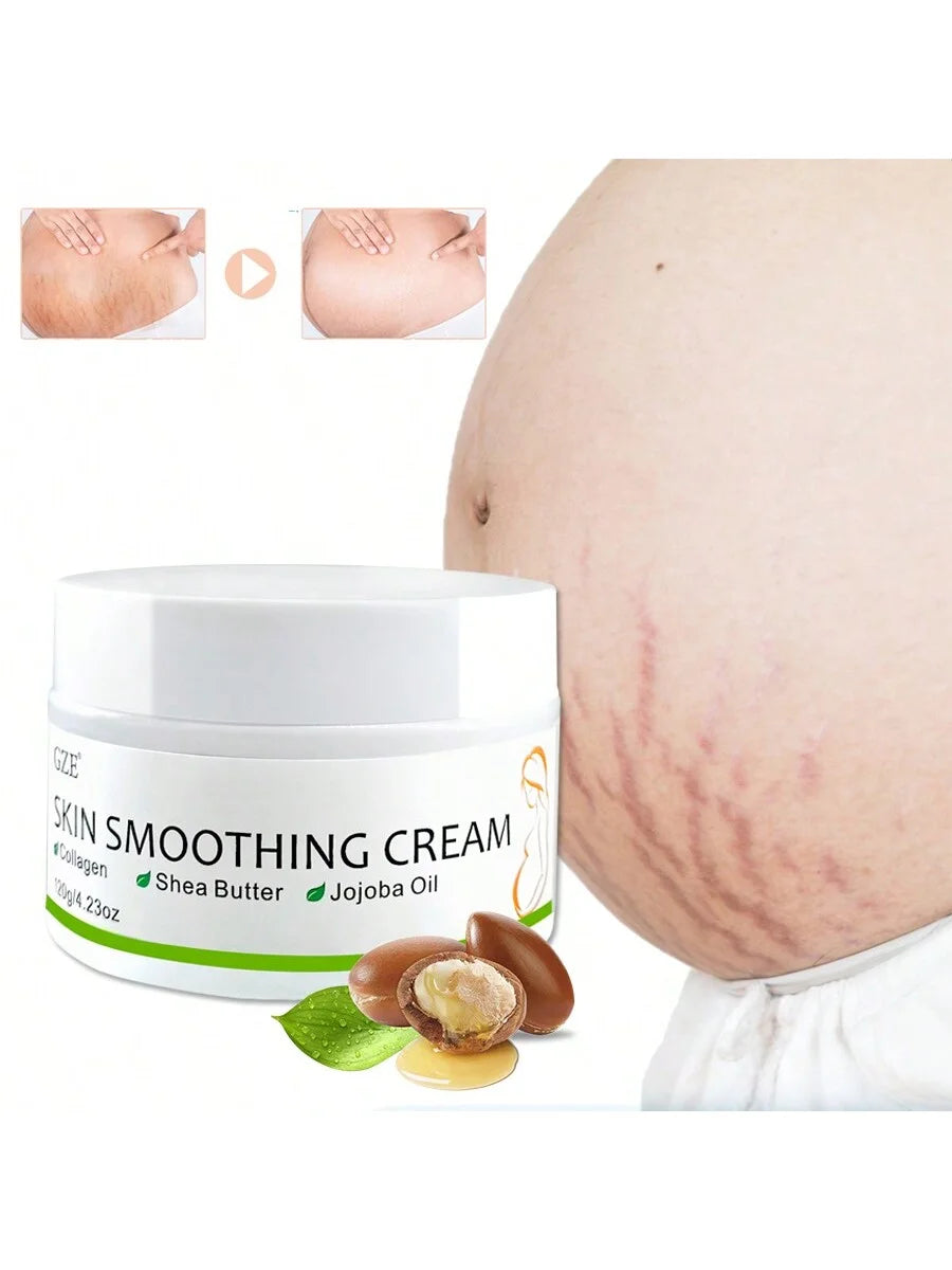 GZE Skin Smoothing Cream with Cocoa Butter & Olive To Lighten Postpartum Obesity Marks And Growth Marks Qme