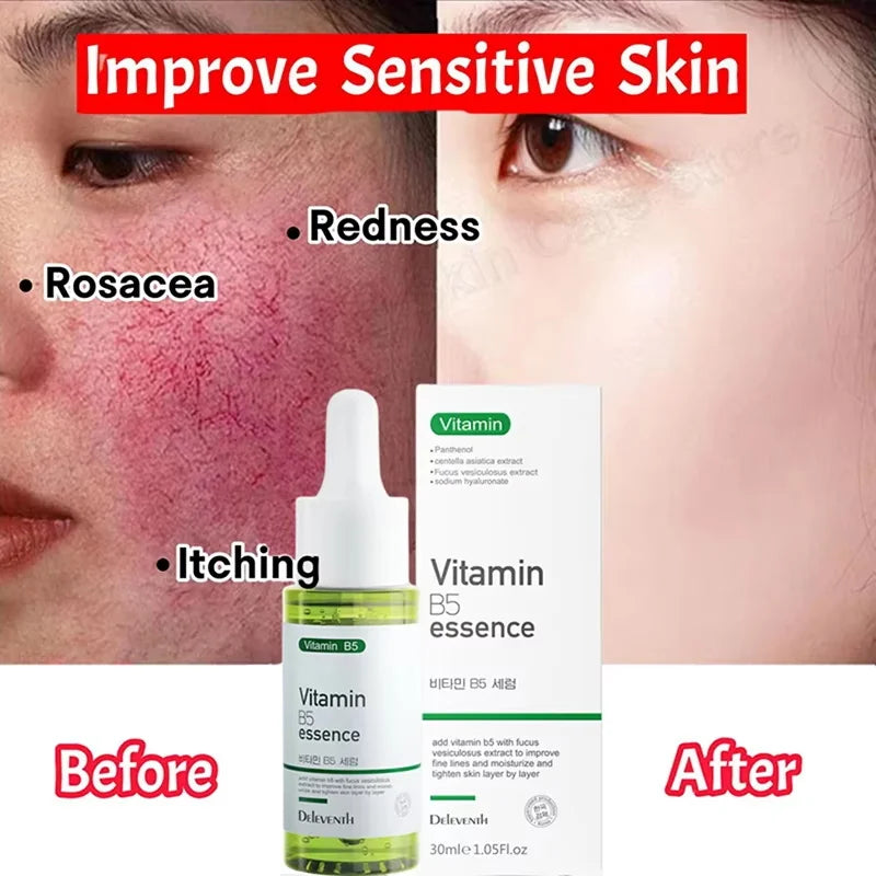 Facial Redness Reduce Serum Improve Sensitive Skin Relieve Dryness Shrink Pores Moisturizer Sooth Lotion Korean Cosmetics Cream Qme