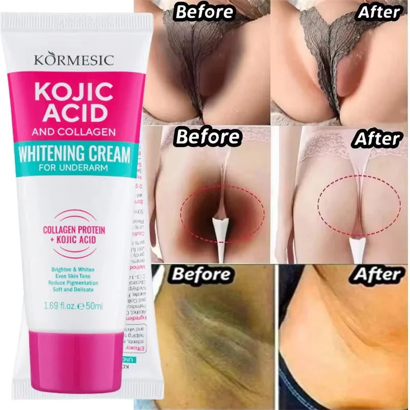 Whitening Cream Private Parts Underarm Bleaching Serum Whiten Butt Knee Brighten Inner Thigh Intimate Parts Dark Remove Melanin Qme 1pc