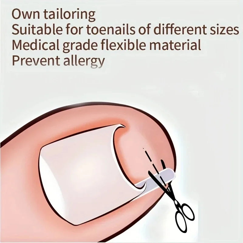 Inward Toe Nail Shaping Tool Invisible Care Pad Groove Adjust Clip Qme