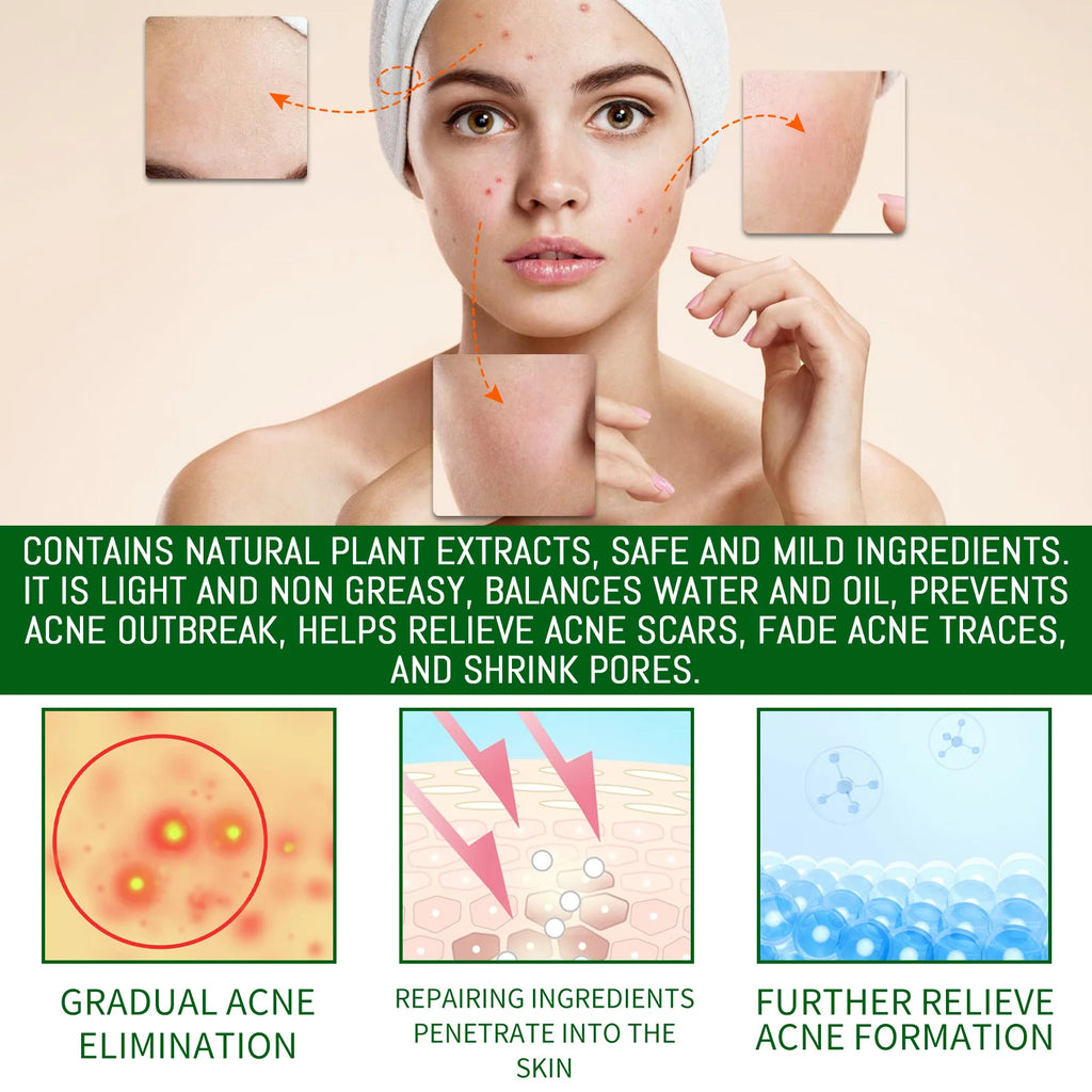 Salicylic Acid Anti Acn-e Face Serum Hydrating Fader Acne Mark Pimple Blackhead Removal Shrink Pores Oil Control Facial Essence Qme