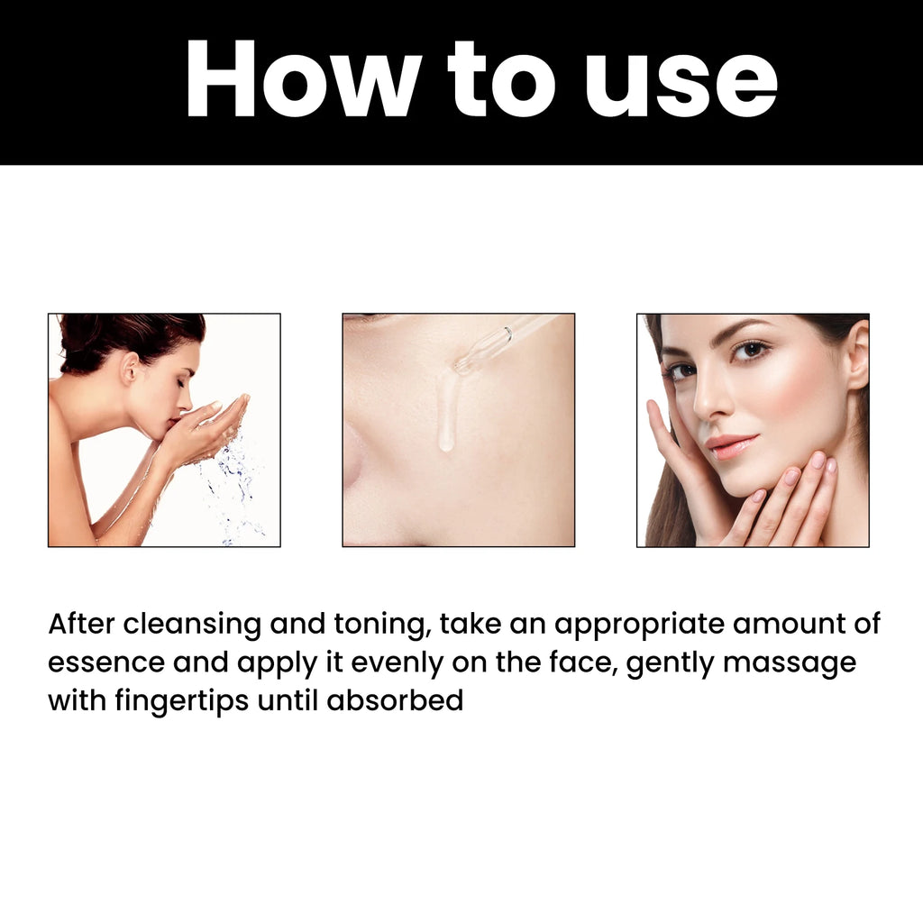 Melanin Correcting Facial Serum Fade Dark Spots Anti Freckle Lightening Pigment Blemish Niacinamide Brightening Face Serum Qme