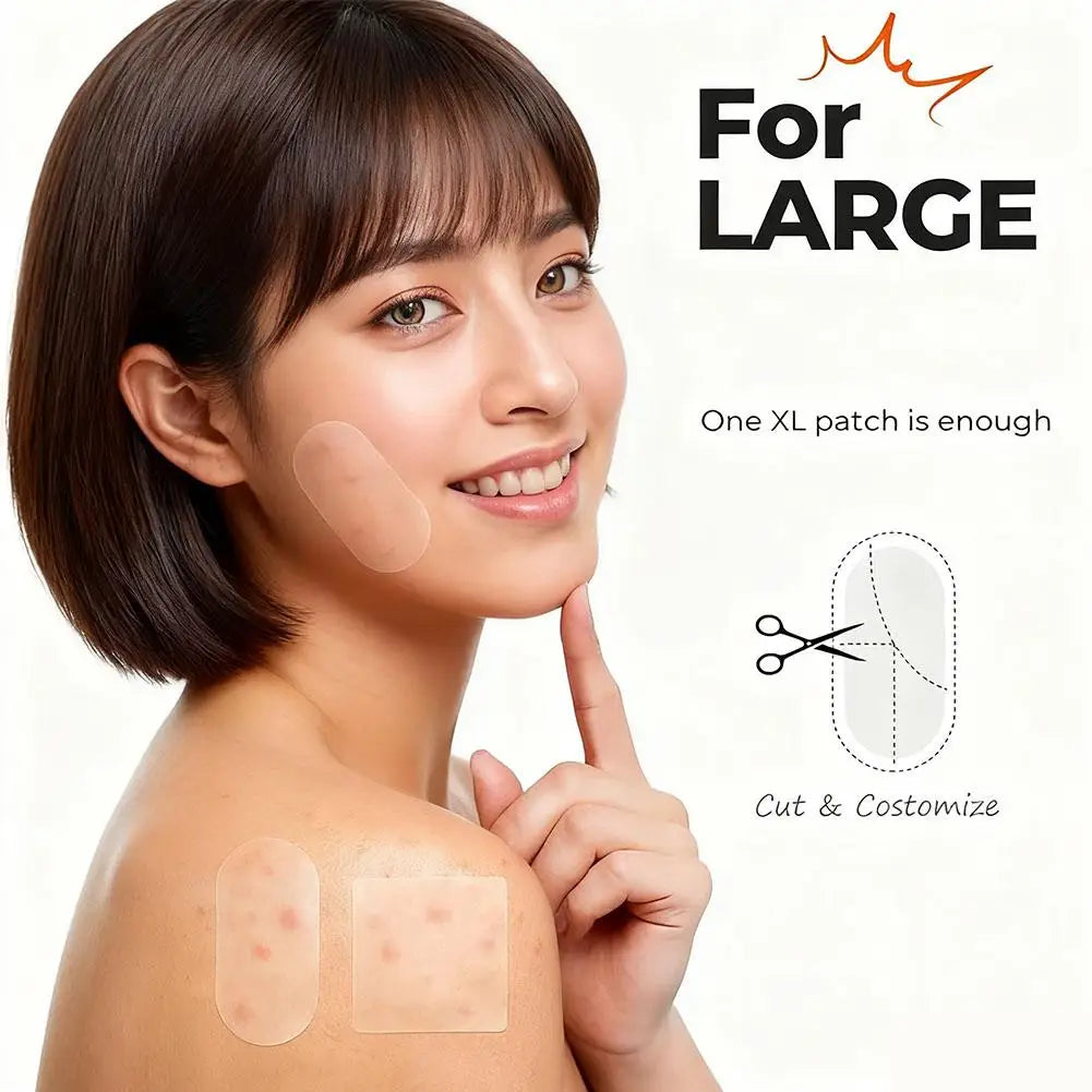 1/10/300pcs Special shaped acne patch Invisible Pimple Cover For Face Oil Control Spot Treatment Sticker Acne Tool Qme