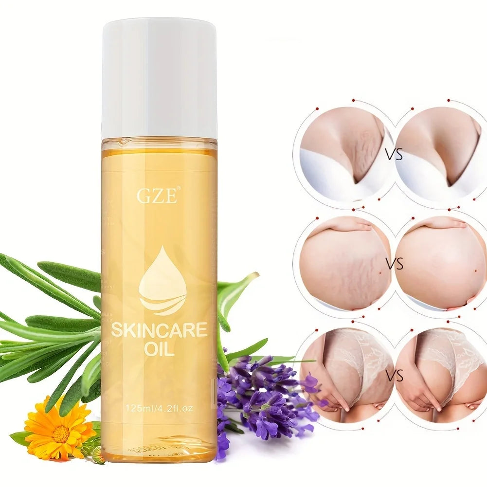 GZE Advanced Stretch Mark Oil for Fading and Preventing Stretch Marks - with Hydrating and Nourishing Ingredients - Weight Loss Qme