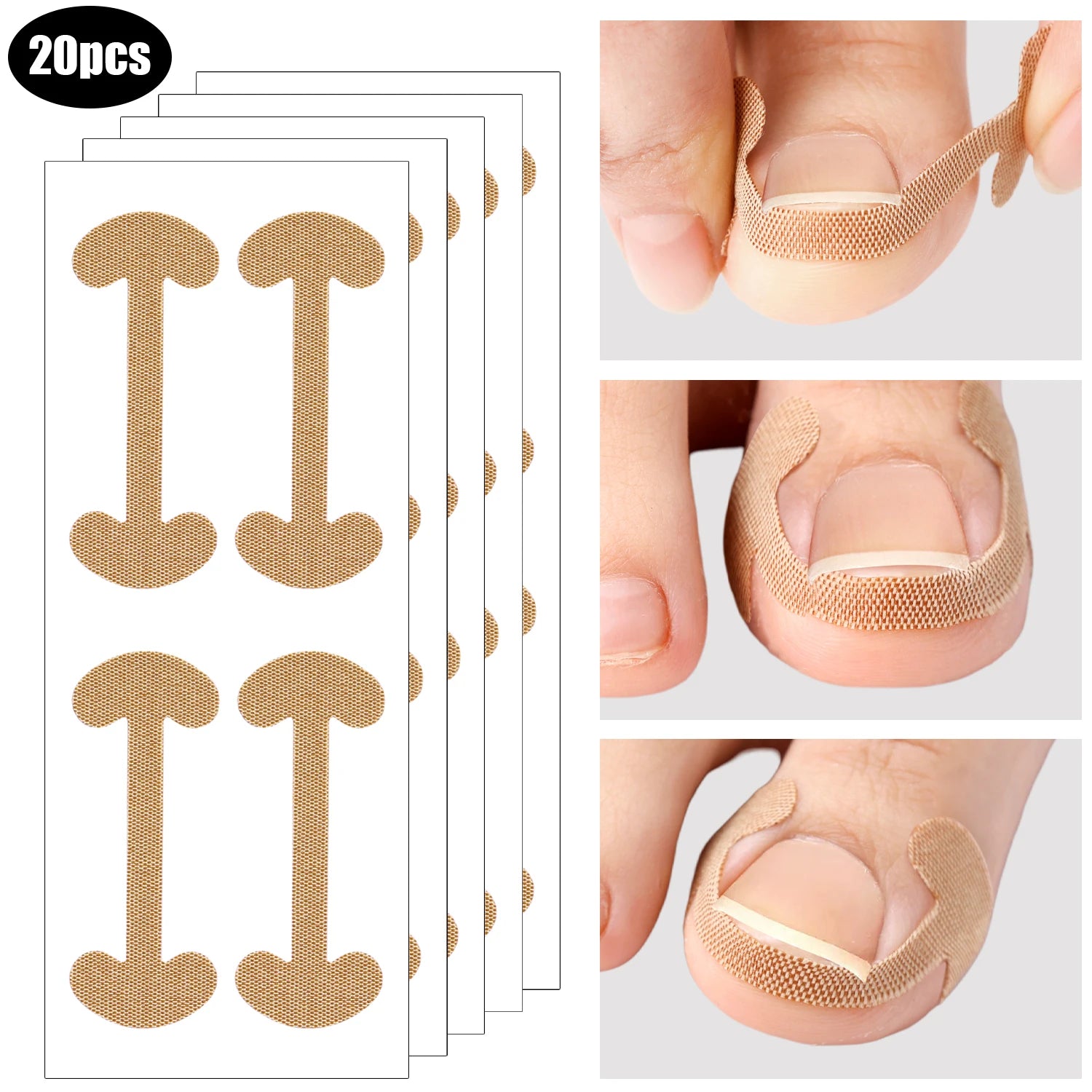 100PCS Ingrown Toenail Correction Strips Lasting Adhesion Waterproof Nail Correction Stickers Elasticity Toe Care Pedicure Tools Qme