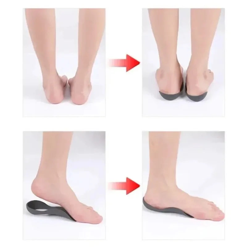 1 Pair Unisex Arch Support Shoe Inserts Orthotic Insoles Flat Feet Qme