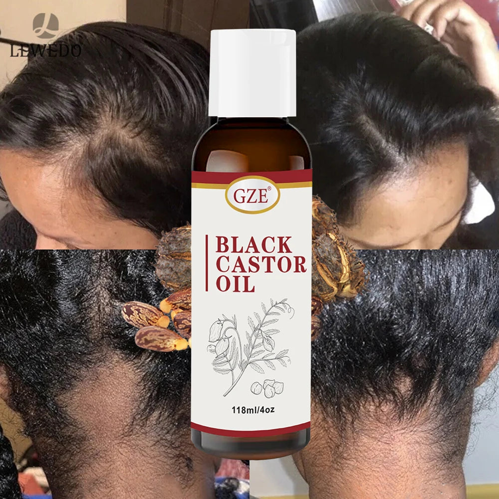 Jamaican Black Castor Oil for Hair Strengthens & Thickens | Body Care - Roasted & Cold-Pressed - Body Massage Oil for Hair Qme
