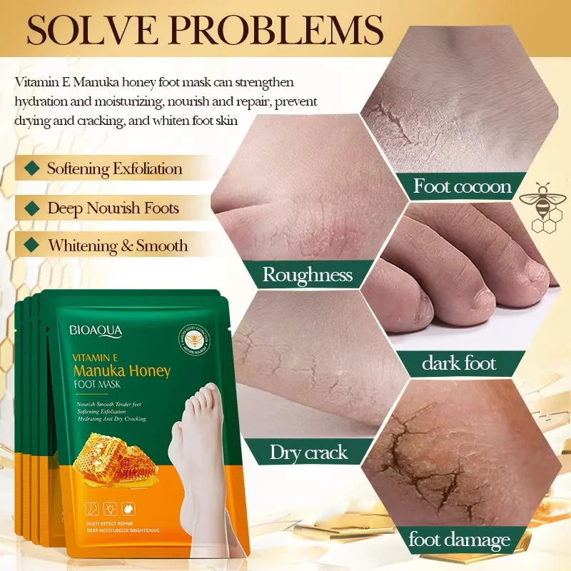 Vitamin E Foot Mask Manuka Honey Nourishing Long-lasting Moisturizing Hydrating Exfoliating Remove Dead Skin Foot Skin Care Qme