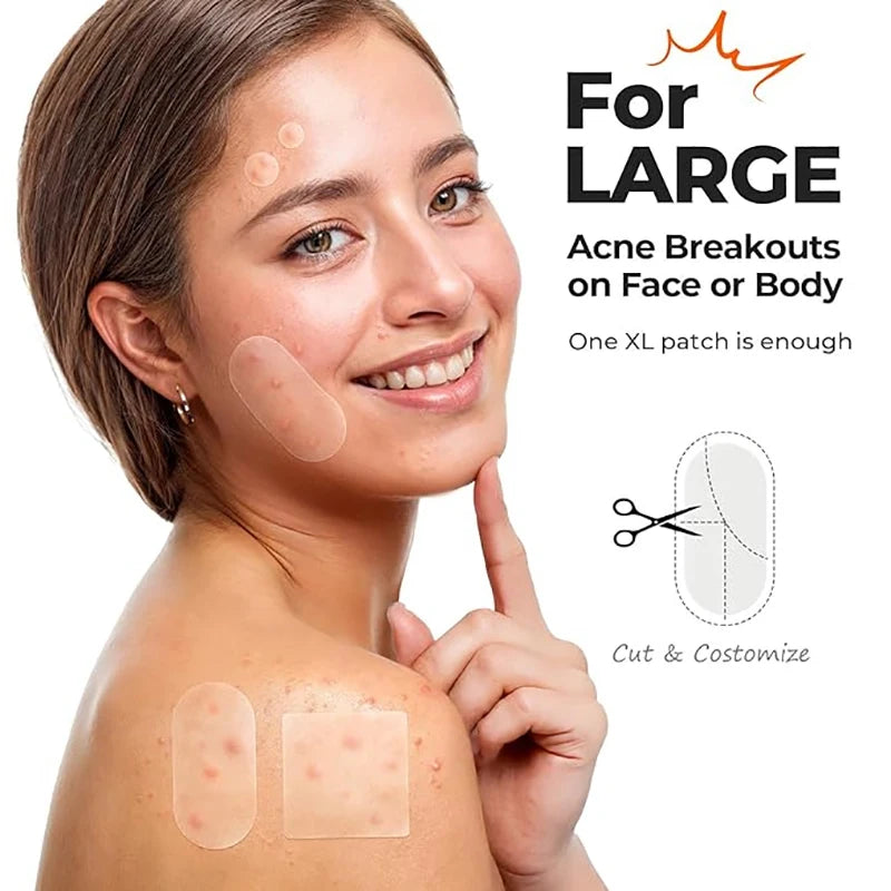 Invisible Acne Treatment Patches Blemish Spot Concealing Repair Qme