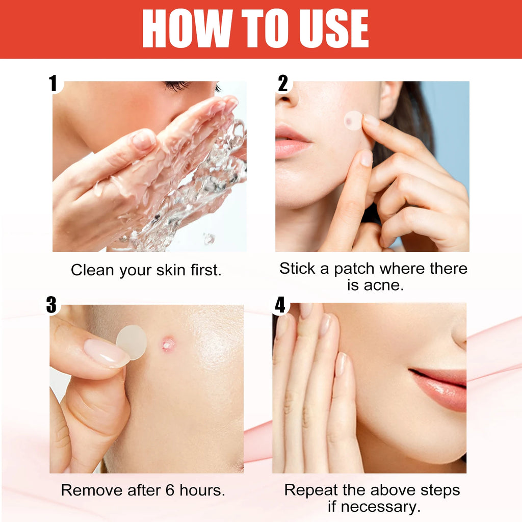 Hydrocolloid Acne Patches 2 Sizes Invisible Makeup-Friendly Pore Care Acne Pimple Patch Breathable for Comedones Treatment Qme