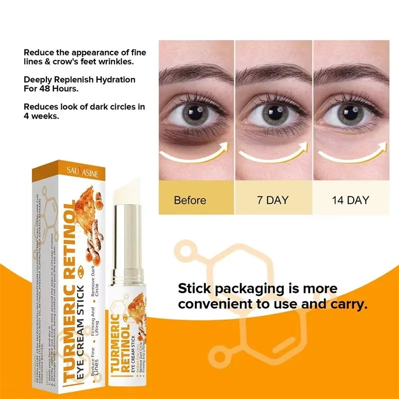 Instant Eye Bag Remove Eye Cream Anti Fat Particles Dark Circles Puffiness Fade Fine Lines Lift Brighten Korean Beauty Eye Care Qme