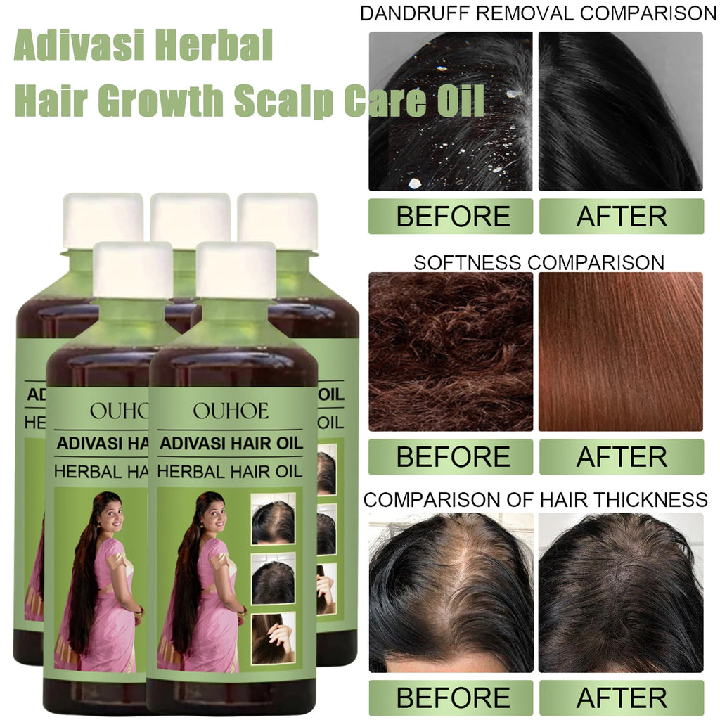 100ml Hair Growth Oil India Adivasi Herbal Hair Care Rosemary Repair Damaged Hydrate Moisturize Scalp Reduce Dandruff Qme