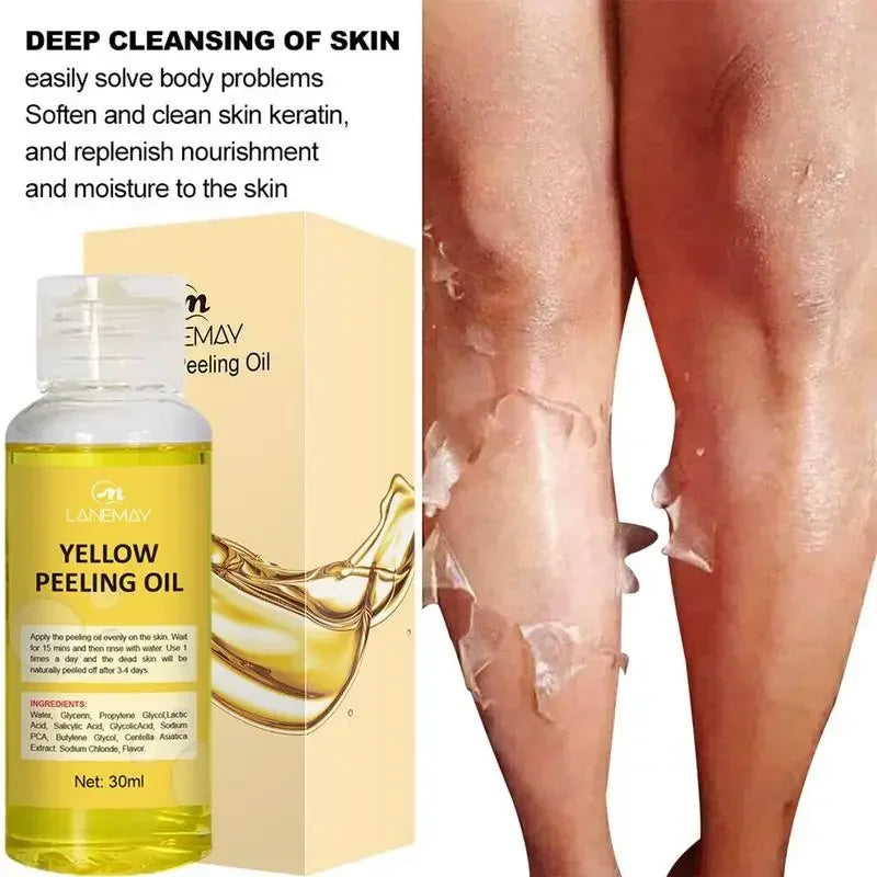 Yellow Peeling Oil Lighten Elbows Knees Hands Melanin Strong Yellow Peeling Oil Even Skin Tone And Whiten Skin Care Supplies Qme