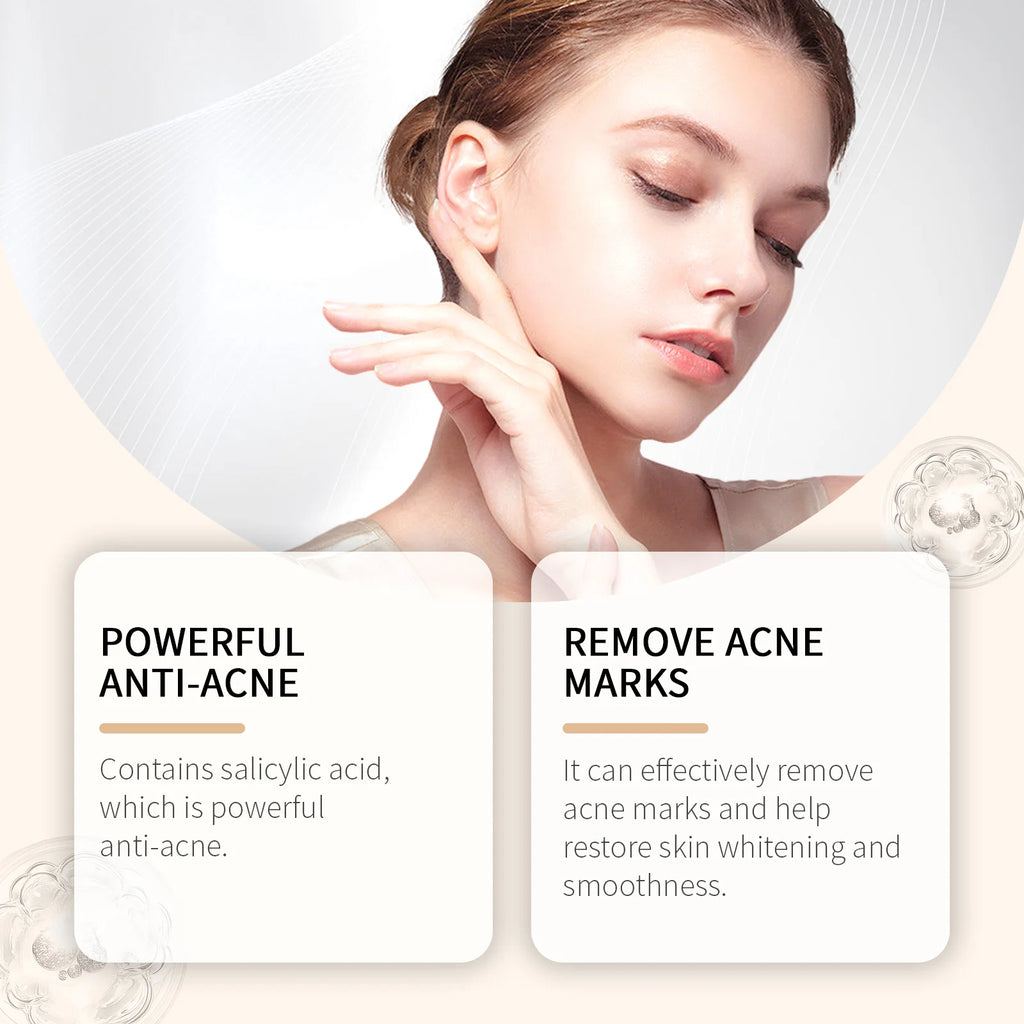 Salicylic Acid Acne Buster Remover Blackhead Oil Control Tenderizing Delicate Pores Pimple Spot Remover Facial Skin Care Essence Qme