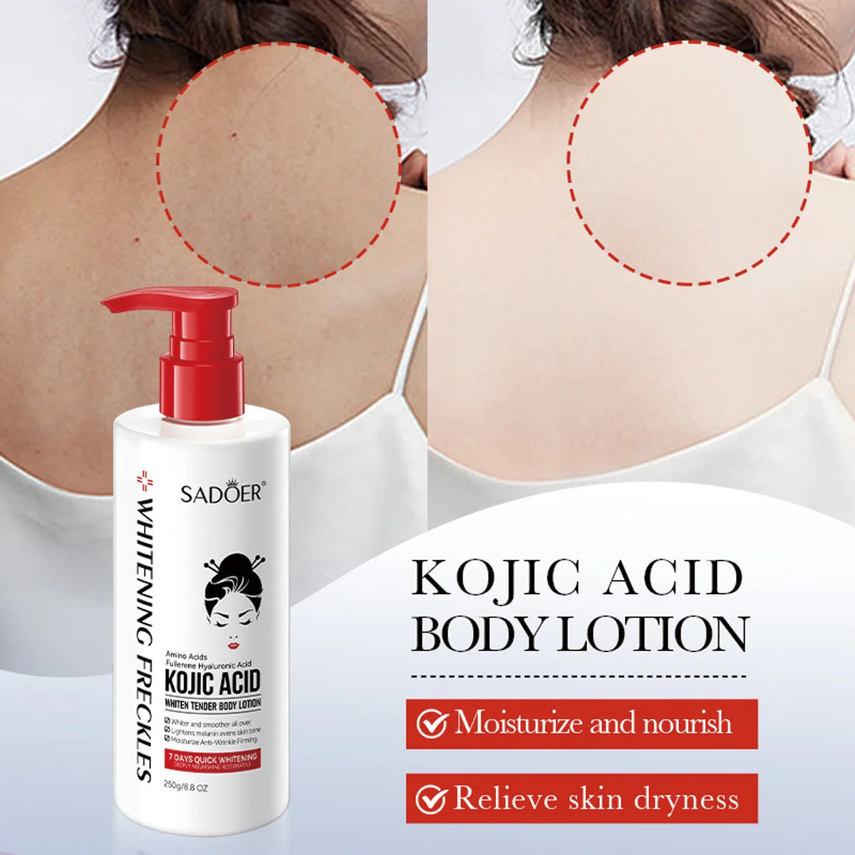 Kojic Acid Whitening Body Lotion Moisturizing Brighten Skin Essential Qme