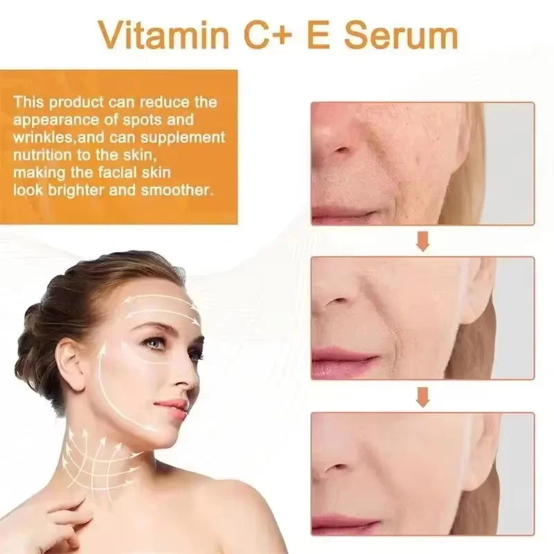 Vitamin C Whitening Serum Remove Freckles Dark Spots Face Essence Fade Melasma Melanin Brighten Repair Dull Skin Care Cosmetics Qme