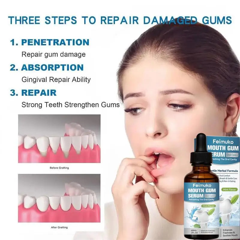Damaged Gum Reduce Serum Effectively Relieve Tooth Allergy Cavities Tooth Cleaning Toothpaste Relieve Tooth Damage Soothing Oil Qme