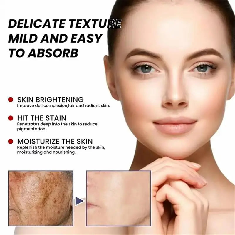Freckle Remove Cream Whiten Face Cream Firming Moisturizing Anti-wrinkle Spot-removing Facial Cream Beauty Skin Care Serum Qme