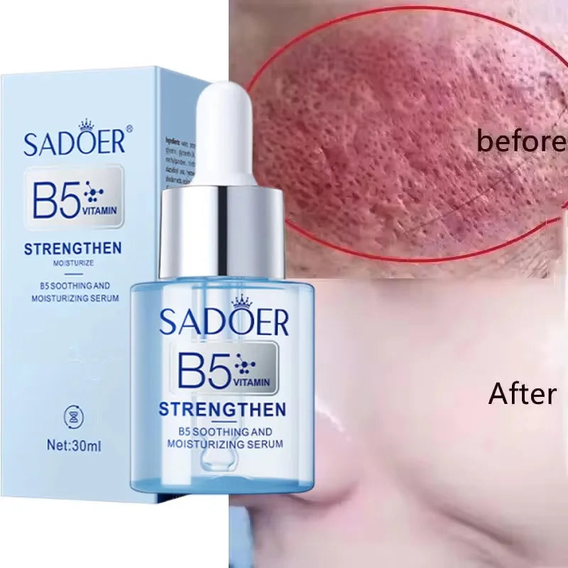 Facial Redness Repair Serum Improve Sensitive Skin Dryness Moisturizer Hydrating Sooth Lotion Removal Rosacea Korean Cosmetics Qme