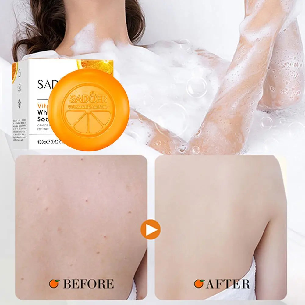 Vitamin C Brightening Soap Hydrating Face Body Radiant Glow Skin Qme