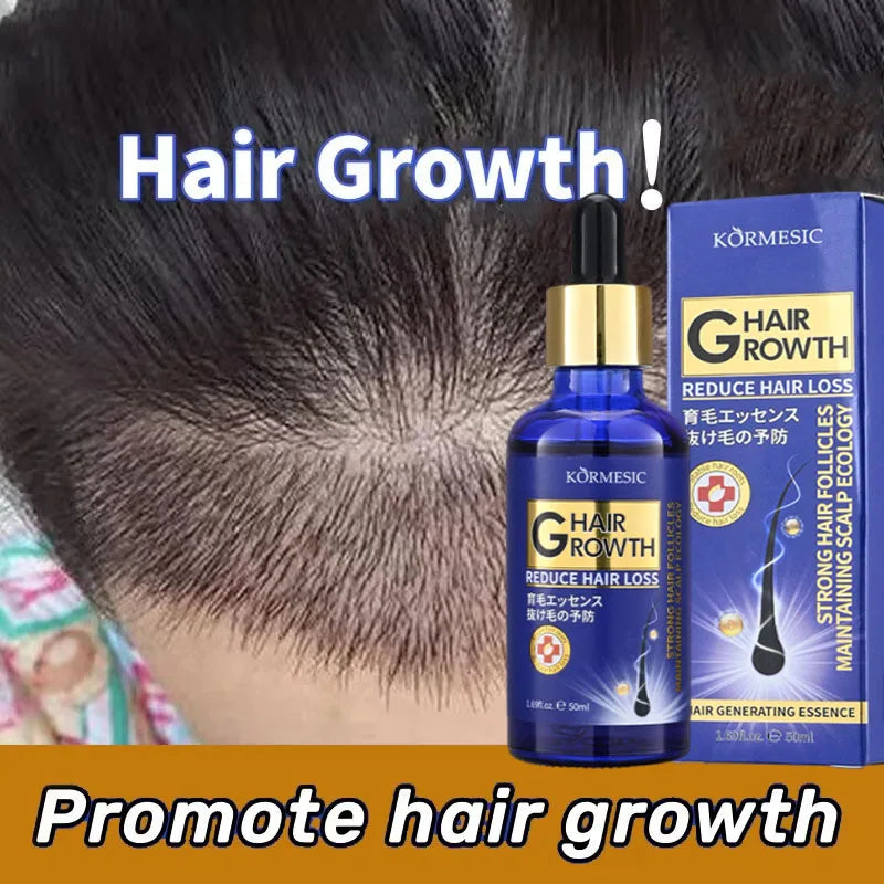 Hair Growth Serum Anti Loss Regrowth Hair Growth Oil Prevent Baldness Repair Damage Scalp Massage Moisturizing Nourish Hair Care Qme