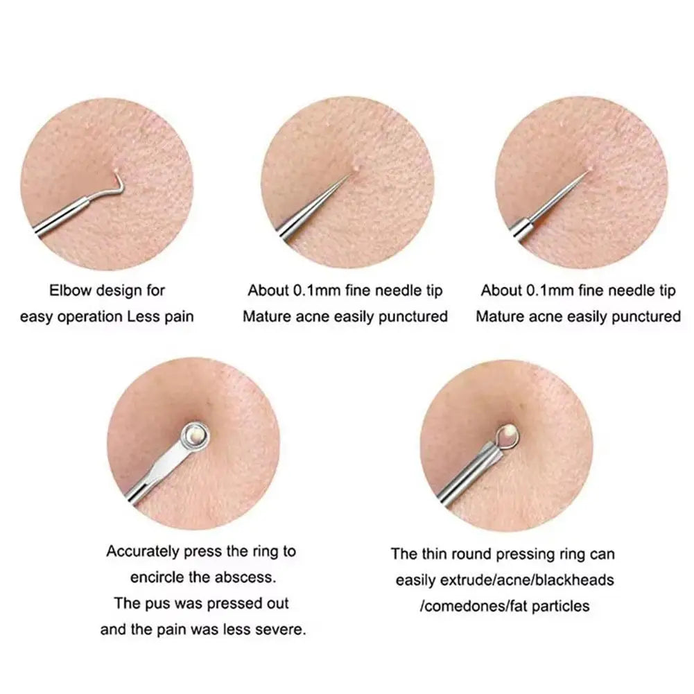 Blackhead Remover Tool Curved Tweezers Acne Needle Pimple Popper Qme