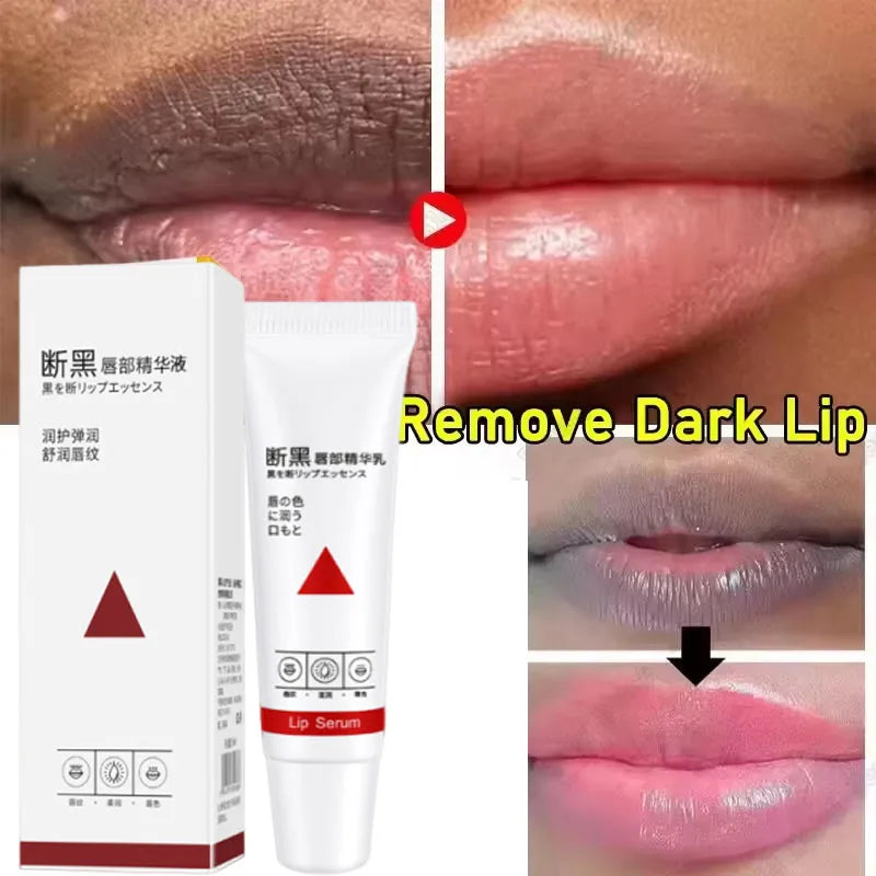 Remove Dark Lip Balm Fast Lightening Pink Lip Exfoliating Fade Lip Line Dead Skin Moisturizer Korean Care Products Beauty Health Qme