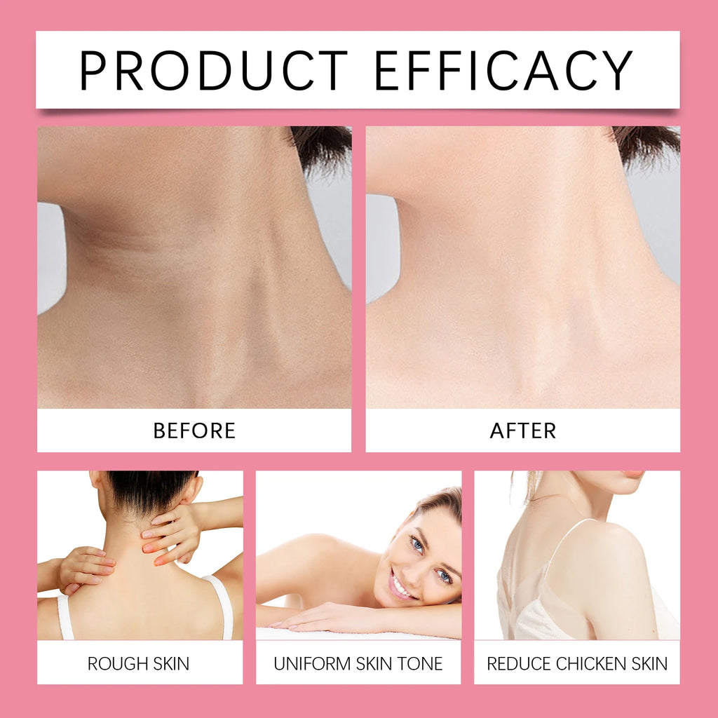 Skin Whitening Serum Private Parts Underarm Bleaching Serum Whiten Butt Knee Brighten Inner Thigh Arm Body Remove Dark Melanin Qme