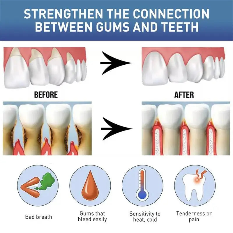 Damaged Gum Reduce Serum Effectively Relieve Tooth Allergy Cavities Tooth Cleaning Toothpaste Relieve Tooth Damage Soothing Oil Qme