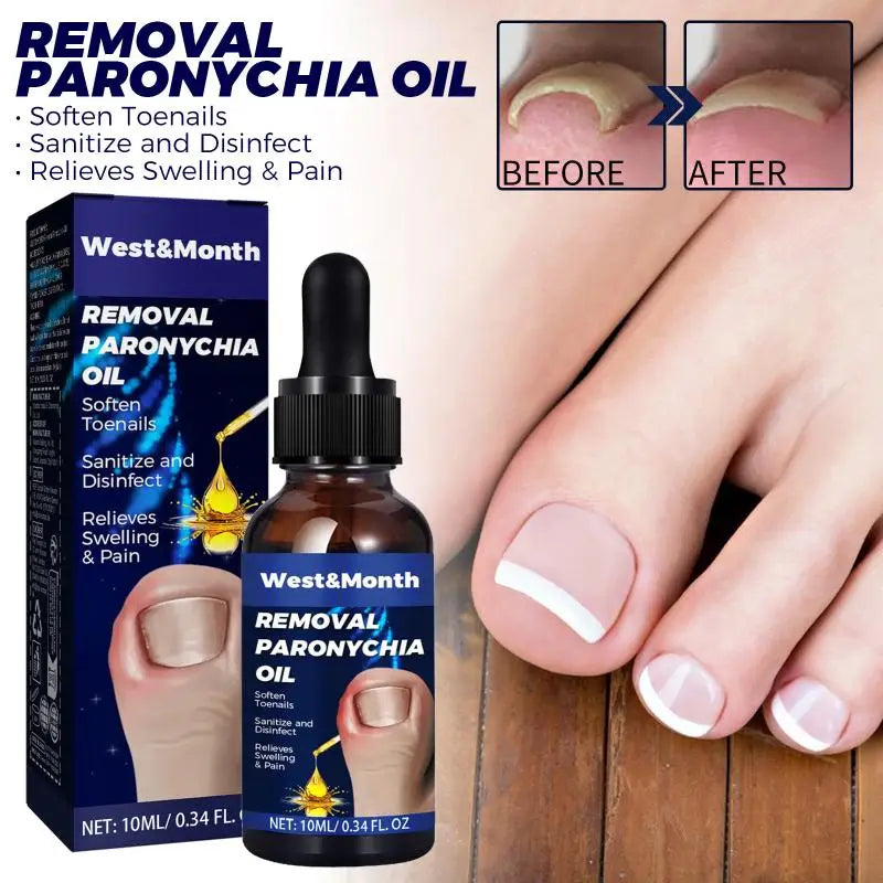 Shoe Sock Odor Deodorant Spray Long Lasting Foot Care Removal Sweat Qme