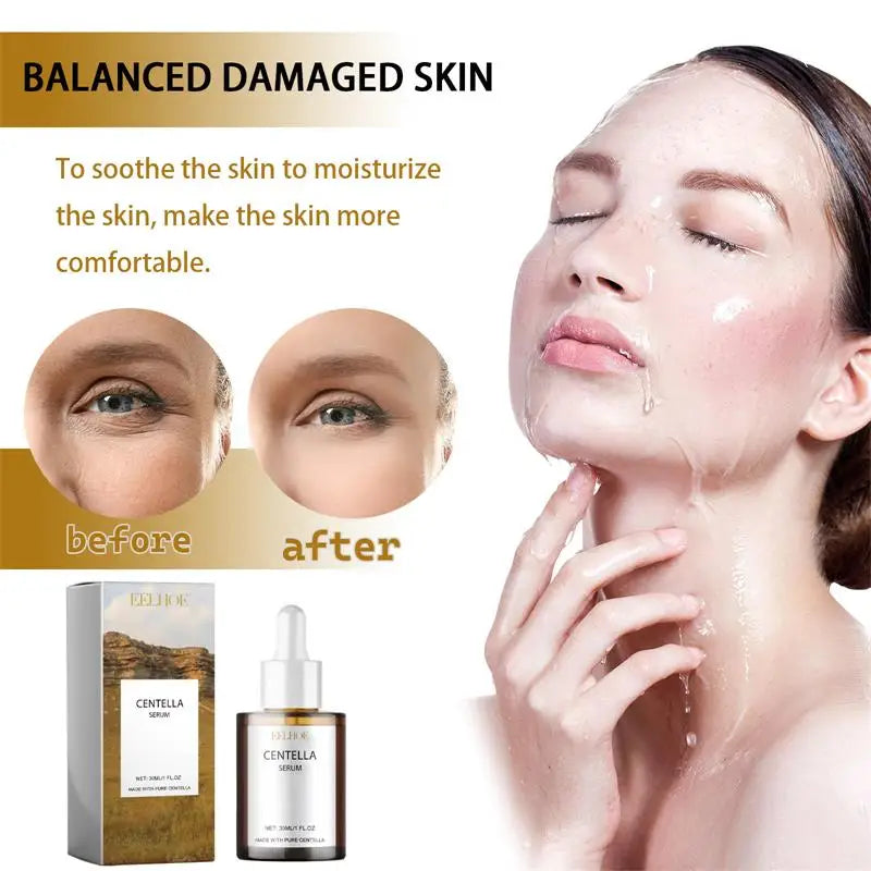 Centella Serum Nourish Improvement Dry Skin Smoothing Rejuvenation Brighten Moisturizing Hyaluronic Acid Face Essence Skin Care Qme