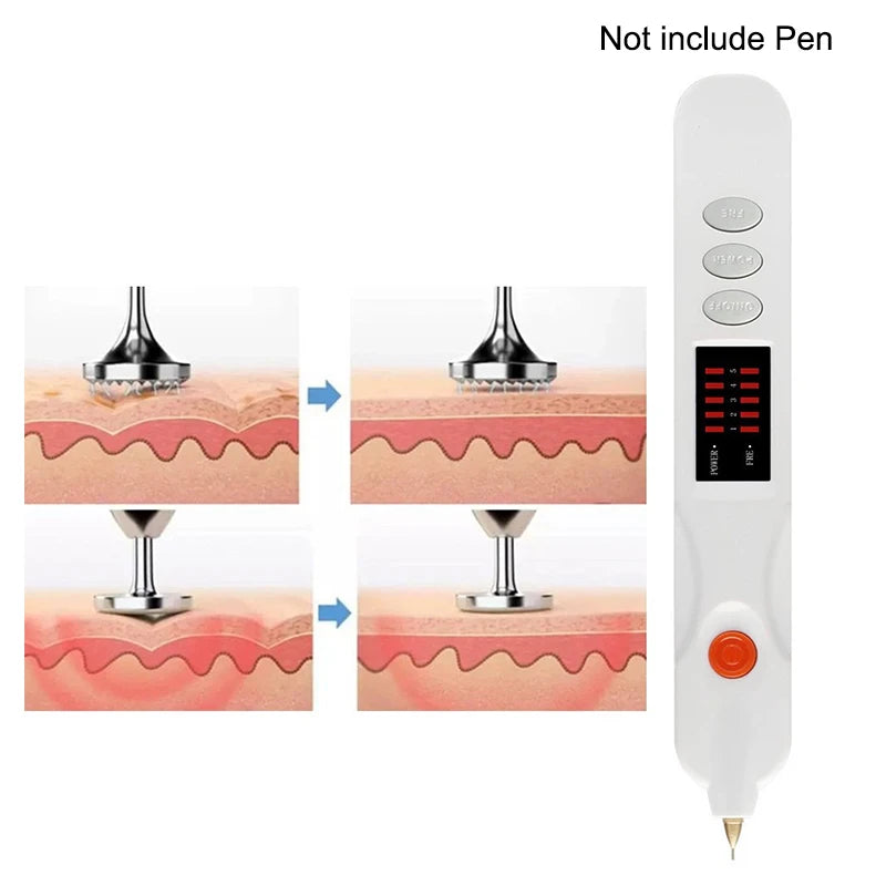 1 2 Replacement Plasma Pen Tip Freckle Wart Mole Wrinkle Removal Dark Qme